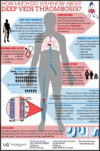 Deep Vein Thrombosis - Vein Specialists of Illinois