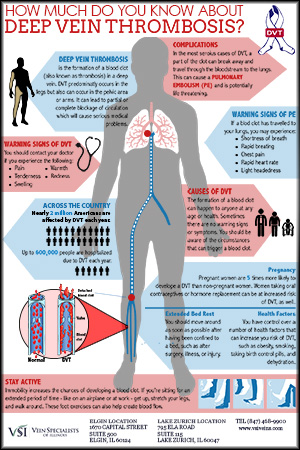 Deep Vein Thrombosis: Causes, Symptoms, Risk Factors, Diagnosis