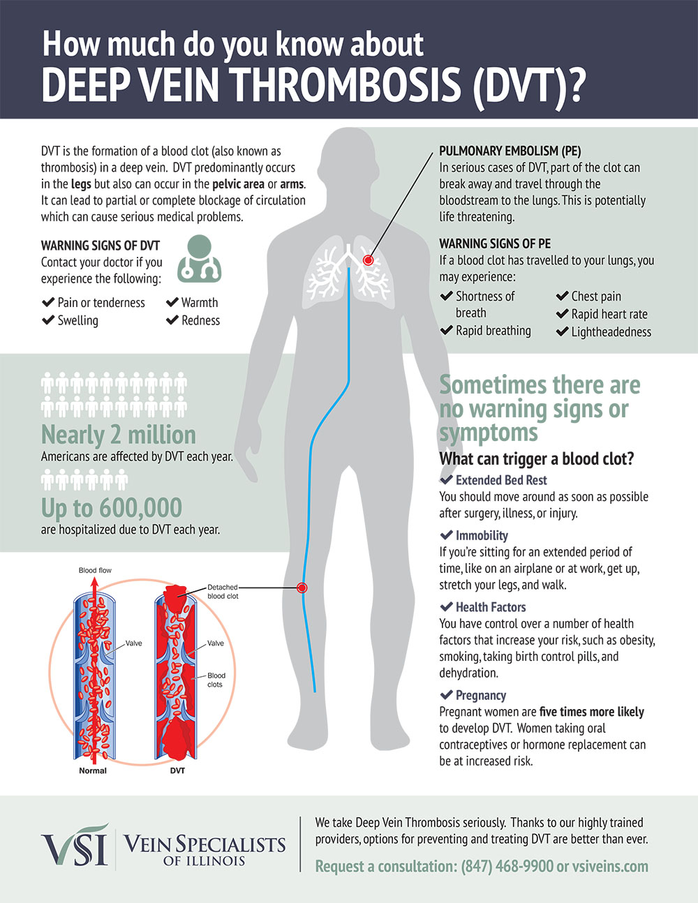 5 Key Facts about Deep Vein Thrombosis